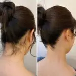 うなじ脱毛って?成人式前の美容にも!メリット・デメリットや失敗しないコツも紹介